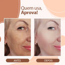 Bálsamo Derol Anti-Rugas (Restauração de Pele) - Modelo Batom