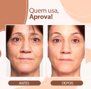 Bálsamo Derol Anti-Rugas (Restauração de Pele) - Modelo Batom